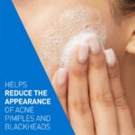 C ACNE CONTROL4