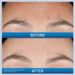 CERAVE RESURFACE RETINOL SERUM 3